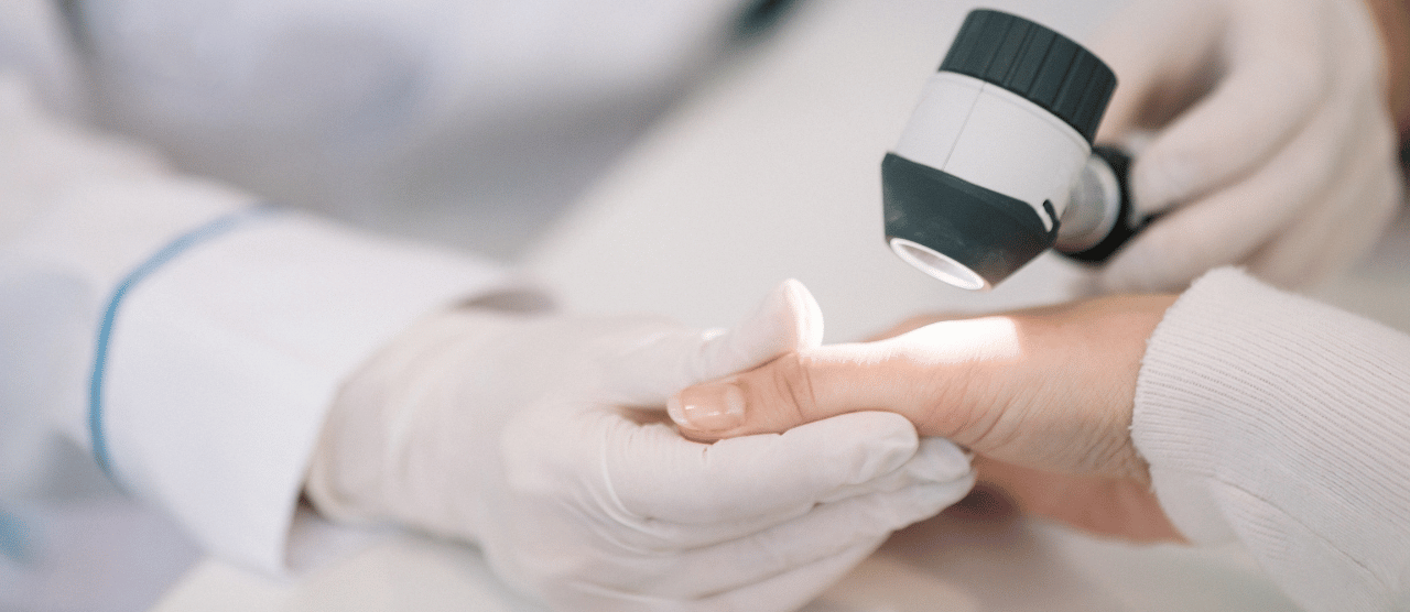 A dermatologist provider inspecting a patient's hand for irregularities in their skin.
